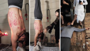 【暴躁七七】双S-吊绑重度虐打-滴蜡-97LZTD-8345415717451618502111199