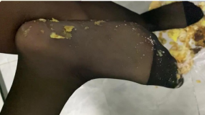 美脚下的盛宴大餐