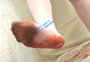 羞涩小护士踩碎金鱼害虫insect cr